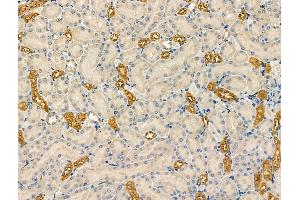ABIN6263517 and ABIN6266843 at 1/100 staining Rat kidney tissue by IHC-P.