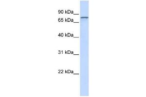 Western Blotting (WB) image for anti-ADAM Metallopeptidase Domain 15 (ADAM15) antibody (ABIN2459014) (ADAM15 anticorps)