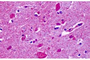 Anti-CELSR2 antibody IHC staining of human brain, cortex, cerebellum. (CELSR2 anticorps  (N-Term))