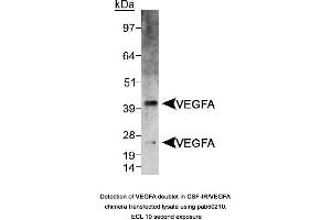 Image no. 1 for anti-Vascular Endothelial Growth Factor A (VEGFA) (AA 150-250), (Internal Region) antibody (ABIN363519) (VEGFA anticorps  (Internal Region))