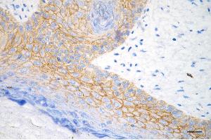 Immunohistochemistry was performed on paraffin-embedded human skin tissue using desmocollin 3 antibody (ABIN7798316), 1:200).