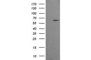 Image no. 1 for anti-Chaperonin Containing TCP1, Subunit 8 (Theta)-Like 2 (CCT8L2) antibody (ABIN1497481) (CCT8L2 anticorps)