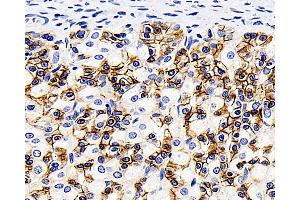 Immunohistochemistry analysis of paraffin-embedded Rat stomach using Catenin beta Monoclonal Antibody at dilution of 1:200.