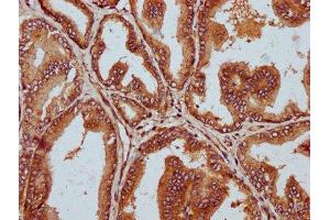 IHC image of ABIN7150607 diluted at 1:300 and staining in paraffin-embedded human prostate tissue performed on a Leica BondTM system.