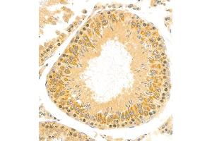 Immunohistochemistry of paraffin embedded rat testis using ptgds (ABIN7075207) at dilution of 1:1700 (300x lens)