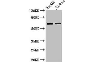 Western Blot Positive WB detected in: HepG2 whole cell lysate, Jurkat whole cell lysate All lanes: RUNX1T1 antibody at 2. (RUNX1T1 anticorps  (AA 416-525))