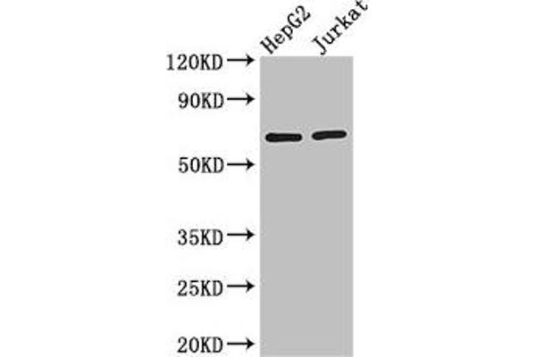 RUNX1T1 anticorps  (AA 416-525)