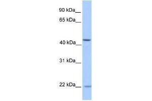 ZNF485 antibody used at 0. (ZNF485 anticorps  (N-Term))