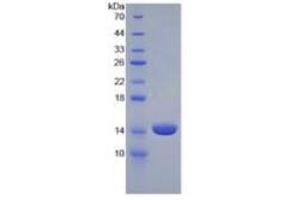 SDS-PAGE of Protein Standard from the Kit (Highly purified E. (Luteinizing Hormone Kit ELISA)