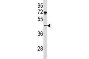 ISL1 antibody western blot analysis in MDA-MB231 lysate.