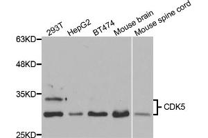 Western blot analysis of extracts of various cell lines, using CDK5 antibody (ABIN5973358) at 1/1000 dilution. (CDK5 anticorps)