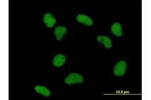Immunofluorescence of purified MaxPab antibody to TDG on HeLa cell. (TDG anticorps  (AA 1-410))