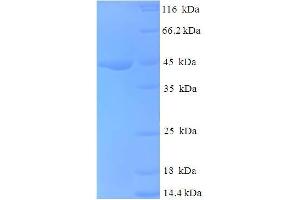 SDS-PAGE (SDS) image for NADH Dehydrogenase (Ubiquinone) 1 alpha Subcomplex, 6, 14kDa (NDUFA6) (AA 27-154), (partial) protein (GST tag) (ABIN5709999)