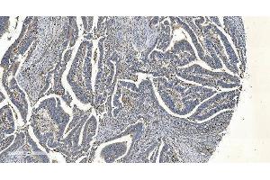 IHC analysis of APPL/APPL1 using anti-APPL/APPL1 antibody (ABIN7602659).