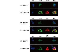 Detection of SOD1 mutants by immunocytochemistry Flag-tagged SOD1 wild type or G93A mutant-expressing HEK293 cells were fixed with 4 % paraformaldehyde/PBS for 10 min at R. (SOD1 anticorps  (ALS-related mutants))