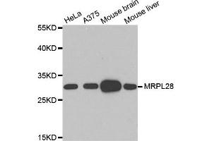 Western Blotting (WB) image for anti-Mitochondrial Ribosomal Protein L28 (MRPL28) antibody (ABIN1876936) (MRPL28 anticorps)