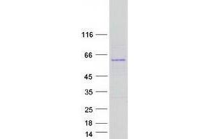 Validation with Western Blot