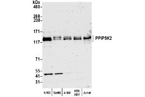 Western Blotting (WB) image for anti-diphosphoinositol Pentakisphosphate Kinase 2 (PPIP5K2) (AA 925-975) antibody (ABIN7450593)