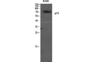 Western Blotting (WB) image for anti-Tumor Protein P73 (TP73) (Tyr220) antibody (ABIN6283720)