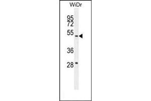 Western blot analysis in WiDr cell line lysates (35 µg/lane) using RT4I1 Antibody (C-term) Cat. (RTN4IP1 anticorps  (C-Term))