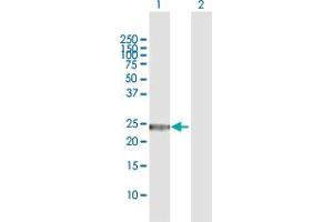 Western Blot analysis of GSTZ1 expression in transfected 293T cell line by GSTZ1 MaxPab polyclonal antibody.