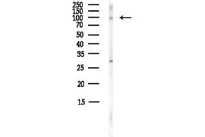 anti-Zinc Finger Protein 598 (ZNF598) (N-Term) antibody