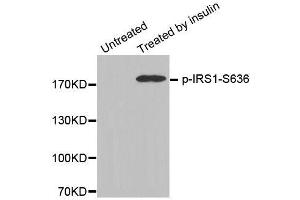 Western blot analysis of extracts from 3T3 cells, using Phospho-IRS1-S636 antibody (ABIN2987656). (IRS1 anticorps  (pSer636))