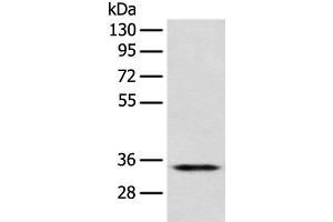 Western blot analysis of Jurkat cell using CD1D Polyclonal Antibody at dilution of 1:300 (CD1d anticorps)