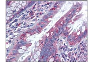 Human Colon: Formalin-Fixed, Paraffin-Embedded (FFPE)