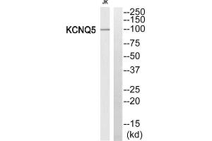 Western blot analysis of extracts from Jurkat cells, using KCNQ5 antibody. (KCNQ5 anticorps  (Internal Region))