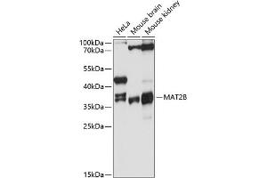 Western blot analysis of extracts of various cell lines, using MB antibody (ABIN6128286, ABIN6143576, ABIN6143577 and ABIN6215296) at 1:3000 dilution. (MAT2B anticorps  (AA 1-334))