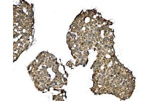 IHC analysis of Elongin-C/ELOC using anti-Elongin-C/ELOC antibody (ABIN7598951).