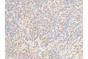 ABIN6267271 at 1/100 staining mouse spleen tissue sections by IHC-P. (c-MYC anticorps  (pSer62))