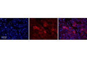 Rabbit Anti-EEA1 Antibody      Formalin Fixed Paraffin Embedded Tissue: Human Adult Liver   Observed Staining: Cytoplasm in hepatocytes, moderate signal, moderate tissue distribution  Primary Antibody Concentration: 1:100  Secondary Antibody: Donkey anti-Rabbit-Cy3  Secondary Antibody Concentration: 1:200  Magnification: 20X  Exposure Time: 0.