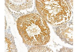 ABIN7094854 and ABIN7098905 at 1/100 staining Rat testis tissue by IHC-P. (PRRG4 anticorps  (Internal Region))