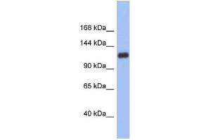WB Suggested Anti-HIF1A Antibody Titration:  0. (HIF1A anticorps  (Middle Region))
