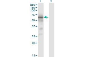 Western Blot analysis of BACE1 expression in transfected 293T cell line by BACE1 monoclonal antibody (M01), clone 2C1. (BACE1 anticorps  (AA 22-501))