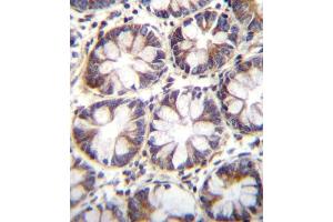 SLC36A1 Antibody (N-term) (ABIN656104 and ABIN2845446) immunohistochemistry analysis in formalin fixed and paraffin embedded human rectum tissue followed by peroxidase conjugation of the secondary antibody and DAB staining.