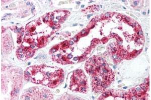Human Kidney (formalin-fixed, paraffin-embedded) stained with HTRA2 antibody ABIN213932 at 5 ug/ml followed by biotinylated goat anti-rabbit IgG secondary antibody ABIN481713, alkaline phosphatase-streptavidin and chromogen. (HTRA2 anticorps  (C-Term))