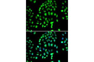 Immunofluorescence analysis of MCF7 cell using PARP3 antibody.