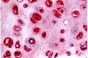 Anti-ADAMTS5 antibody  ABIN1048295 IHC staining of human cartilage.