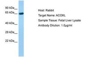 Image no. 1 for anti-Acyl-CoA Oxidase-Like (ACOXL) (AA 361-410) antibody (ABIN6750231) (ACOXL anticorps  (AA 361-410))