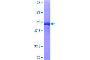 Image no. 1 for Dimethylarginine Dimethylaminohydrolase 1 (DDAH1) (AA 1-285) protein (GST tag) (ABIN1351250)