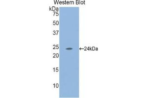 Detection of Recombinant LAMa2, Mouse using Polyclonal Antibody to Laminin Alpha 2 (LAMa2)