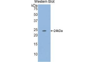 Detection of Recombinant LAMa2, Mouse using Polyclonal Antibody to Laminin Alpha 2 (LAMa2) (Laminin anticorps  (AA 2901-3106))