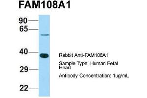 Host: Rabbit  Target Name: FAM108A1  Sample Tissue: Human Fetal Heart  Antibody Dilution: 1. (ABHD17A anticorps  (C-Term))