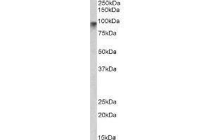 ABIN2564110 (2µg/ml) staining of Human Pancrease lysate (35µg protein in RIPA buffer). (Neuroligin 2 anticorps  (Internal Region))