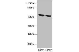 Western blot All lanes: PNPLA2 antibody at 10 μg/mL Lane 1: Mouse liver tissue Lane 2: NIH/3T3 whole cell lysate Secondary Goat polyclonal to rabbit IgG at 1/10000 dilution Predicted band size: 56, 20 kDa Observed band size: 56 kDa (PNPLA2 anticorps  (AA 1-504))