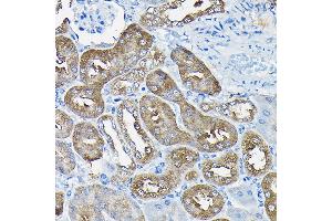 Immunohistochemistry of paraffin-embedded mouse kidney using Nesprin 1 Rabbit pAb (ABIN7270520) at dilution of 1:100 (40x lens). (SYNE1 anticorps)