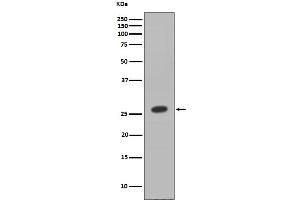 Western blot analysis of HOXB9 expression in MCF7 cell lysate.